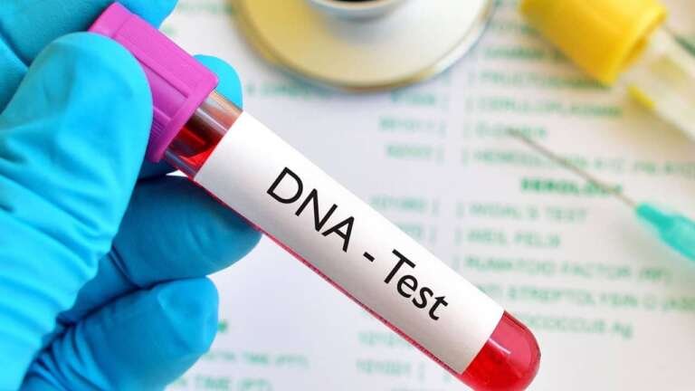 DNA test in Kenya