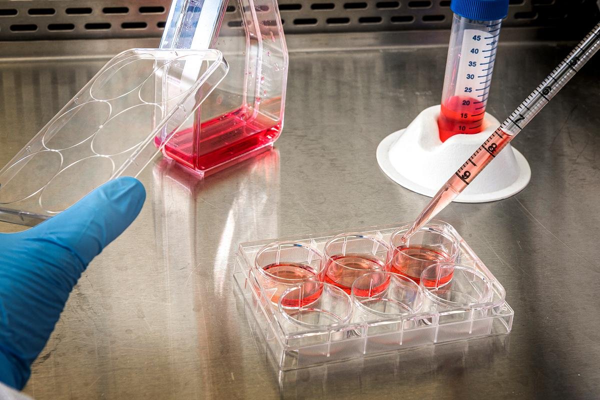 The Myths, The Facts and The Fear: Understanding Ebola in 2026